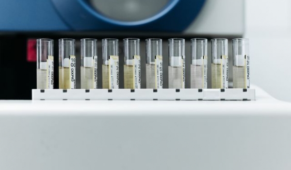 Water quality monitoring